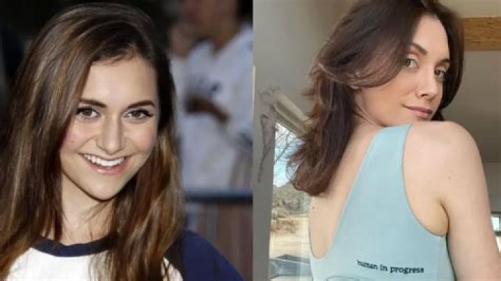 Alyson Stoner’s Nose Job: Before And After Transformation!