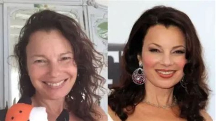 Fran Drescher’s Plastic Surgery: Her Transformation Examined!