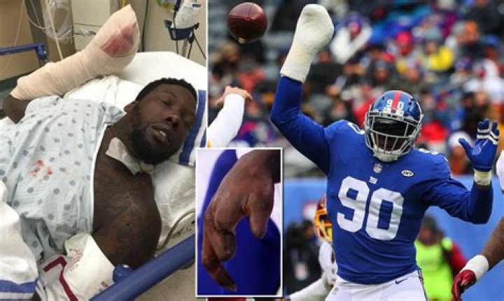 Jason Pierre-Paul's Fireworks Accident Cost Him $6.1 Million... And That Could Just Be The Beginning