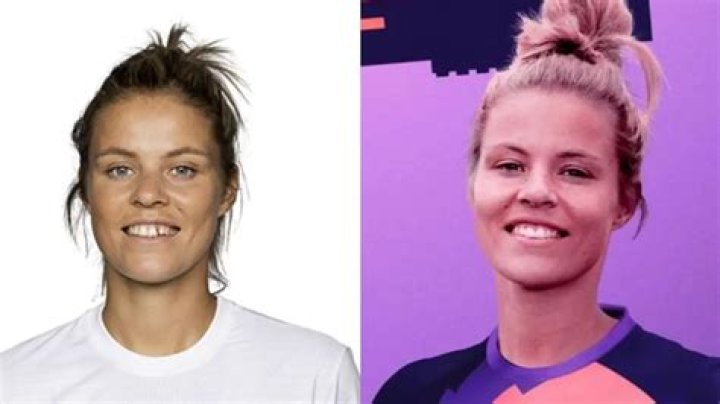 Rachel Daly’s Teeth: Did She Wear Braces to Minimize Her Tooth Gap?