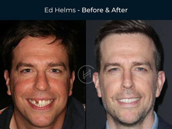 Who is Ed Helms Dating Now?